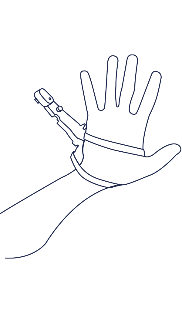 6thfinger_line_good