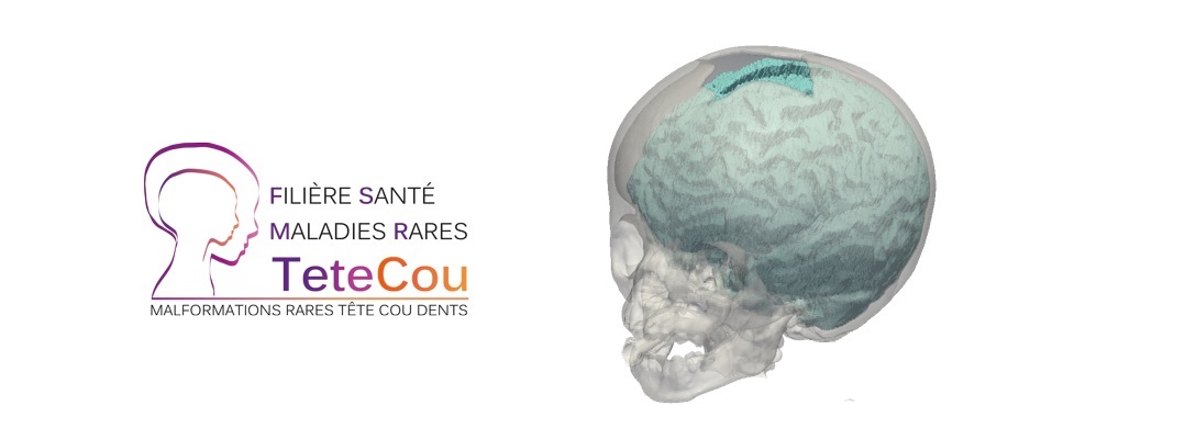 The ICAR research-team belongs to the network ''Tête-Cou'' (Face-Neck) which is one of the French rare-disease clincial research network.