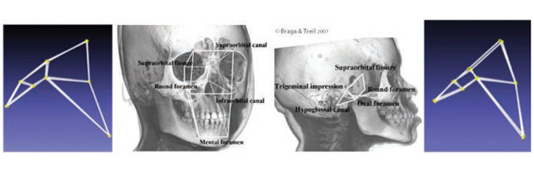 points of difference between shapes of human skull and monkey skull
