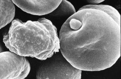 Plasmodium falciparum picture