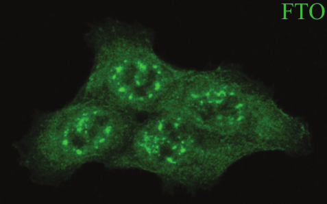 Cells viewed on the microscope. FTO location highlighted in green (Scale bar 10 μm).